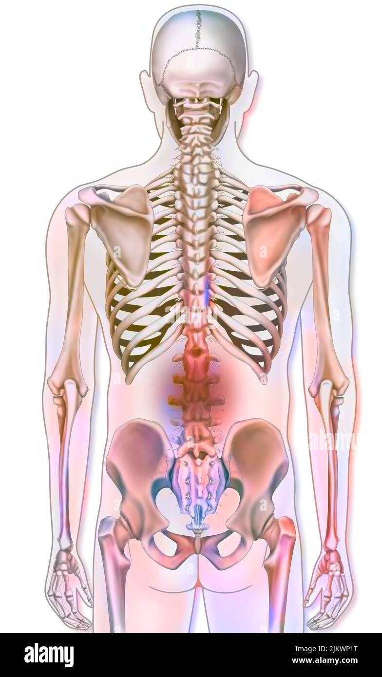 Bone system: human skeleton with representations of lumbar pain. Stock Photo