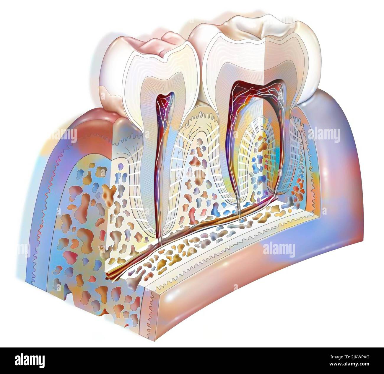 Dental plaque: main pathologies of the teeth: tartar, gingivitis. Stock Photo