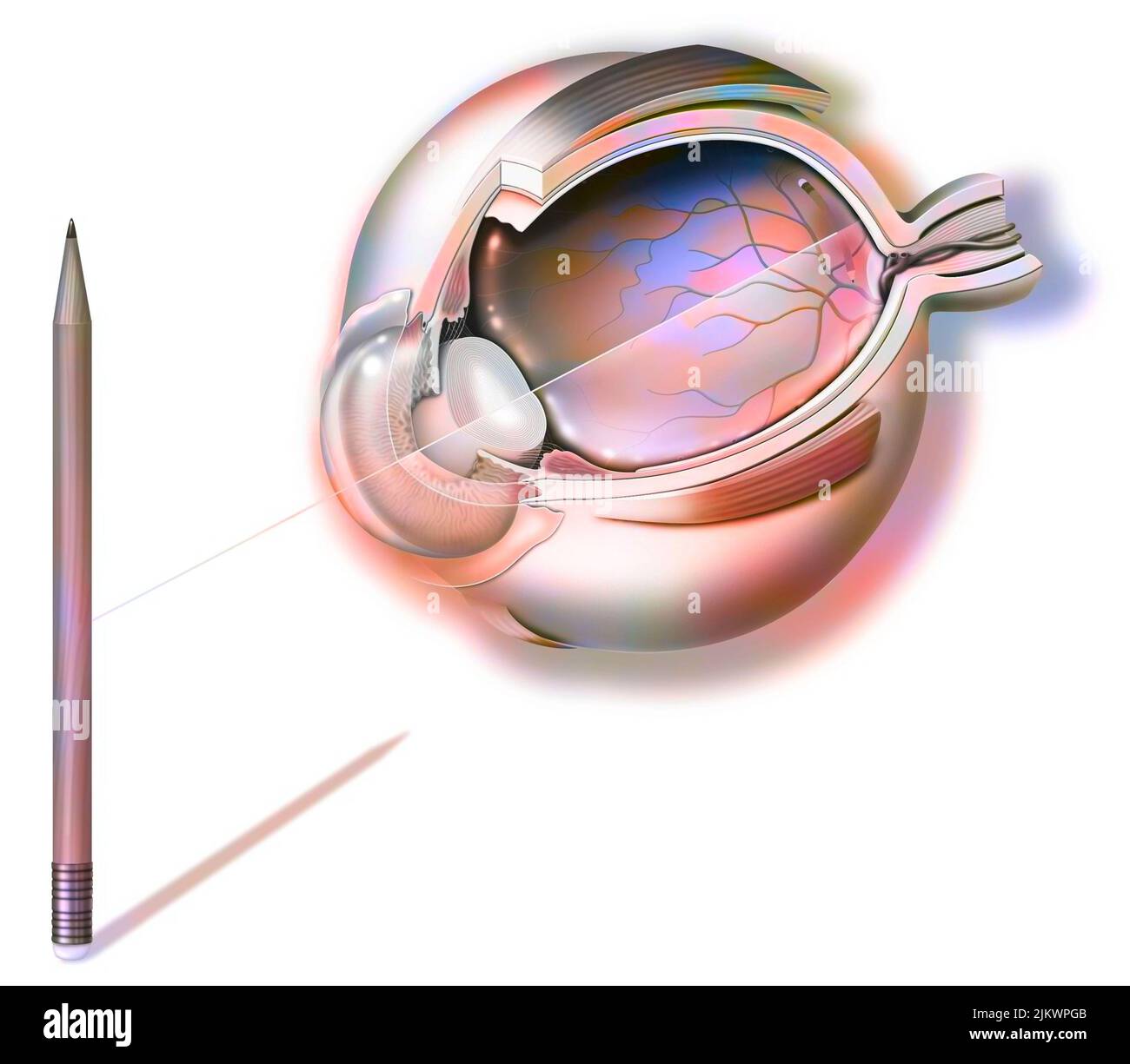 Anatomy of an eye and vision, pencil reflection on the retina. Stock Photo