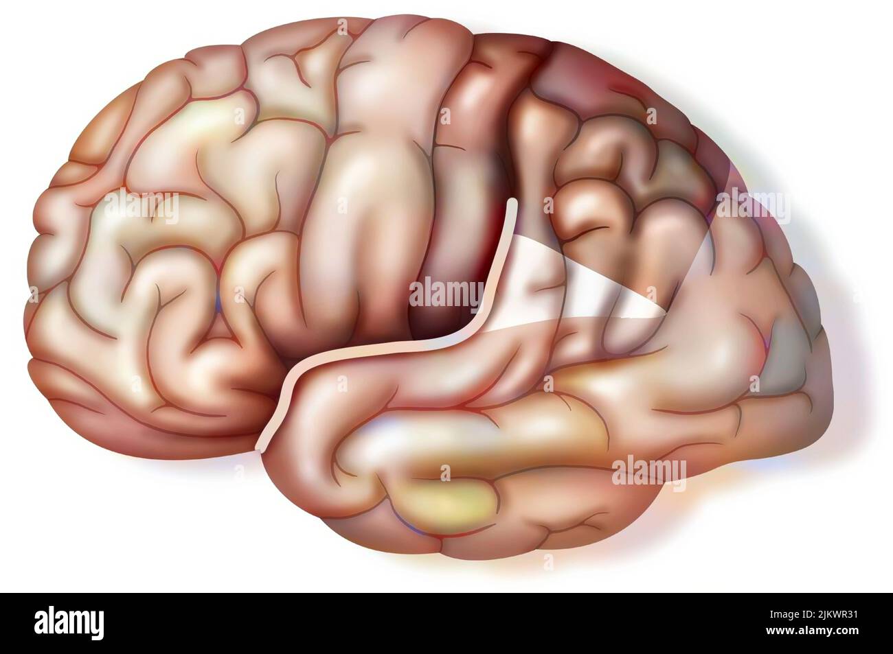 Particularity of the brain of Einstein which presents a fissure of Sylvius which goes up. Bsip 005233 091 N2I24 1 BSIP1 Stock Photo