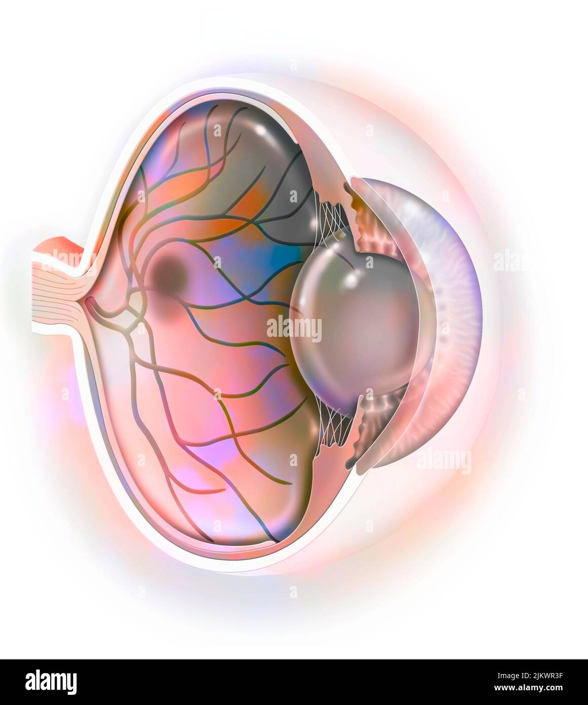 Age-related macular degeneration affecting the macula, the central area of the retina. Stock Photo