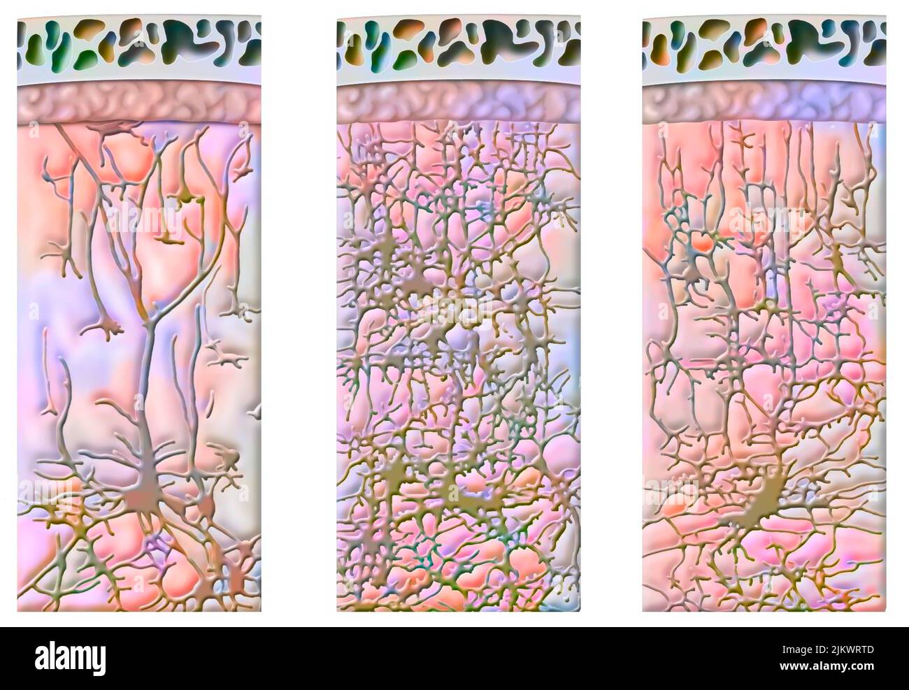 Development of the cell network of the cerebral cortex of a child at 9 months then 2 and 4 years old. Stock Photo