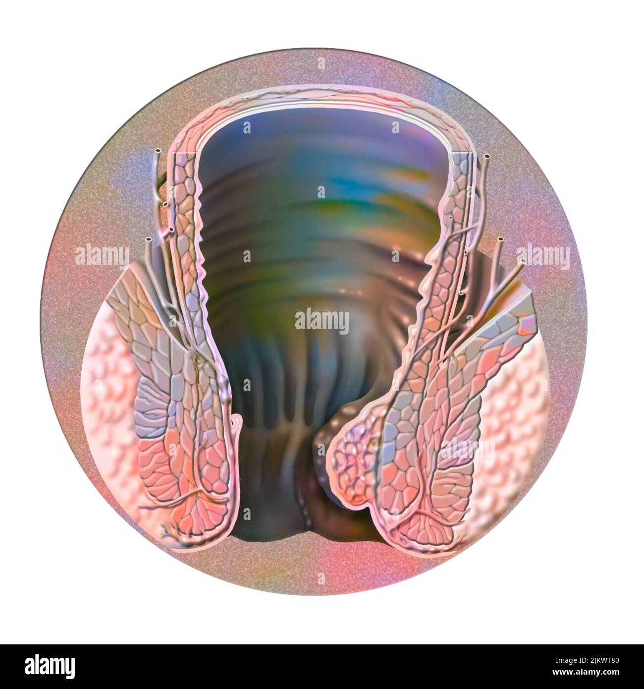 Internal hemorrhoidal plexus and location of internal hemorrhoids Stock Photo Alamy