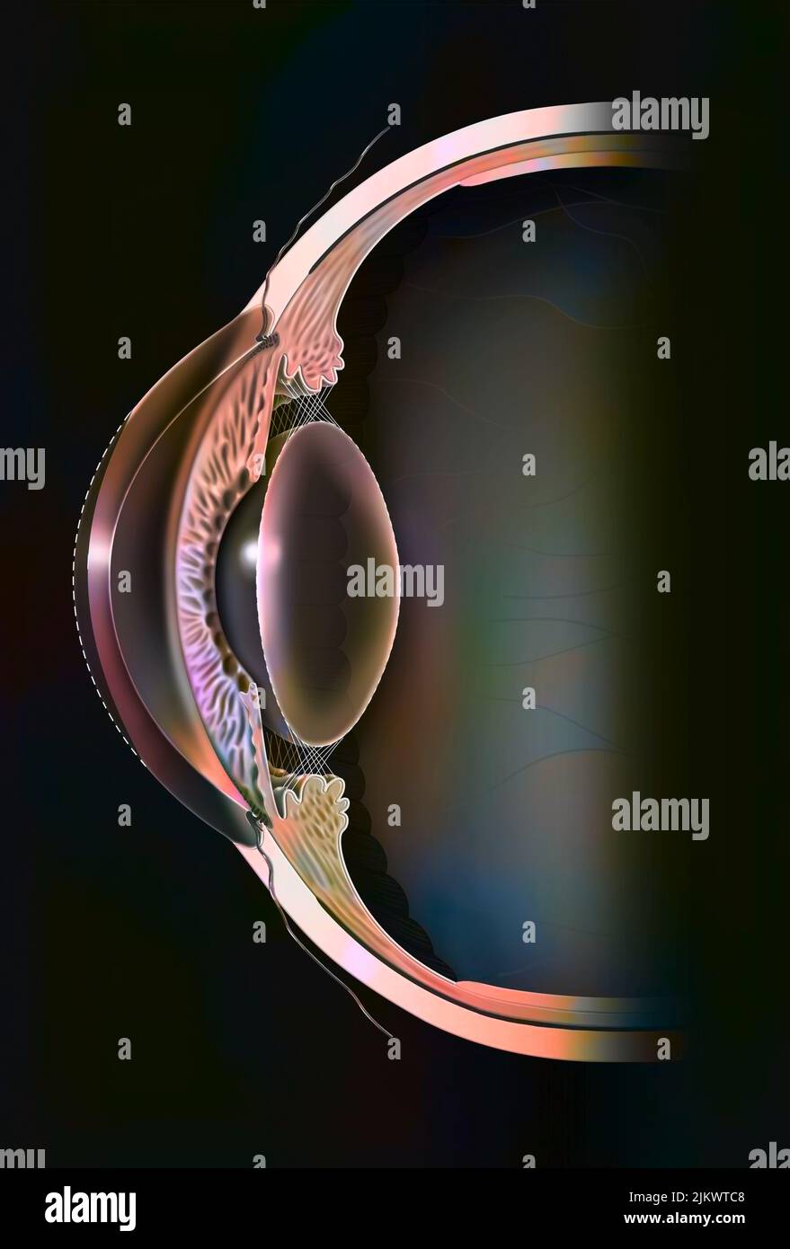 Astigmatic eye (ovoid and non-spherical cornea) inducing distorted vision. Stock Photo