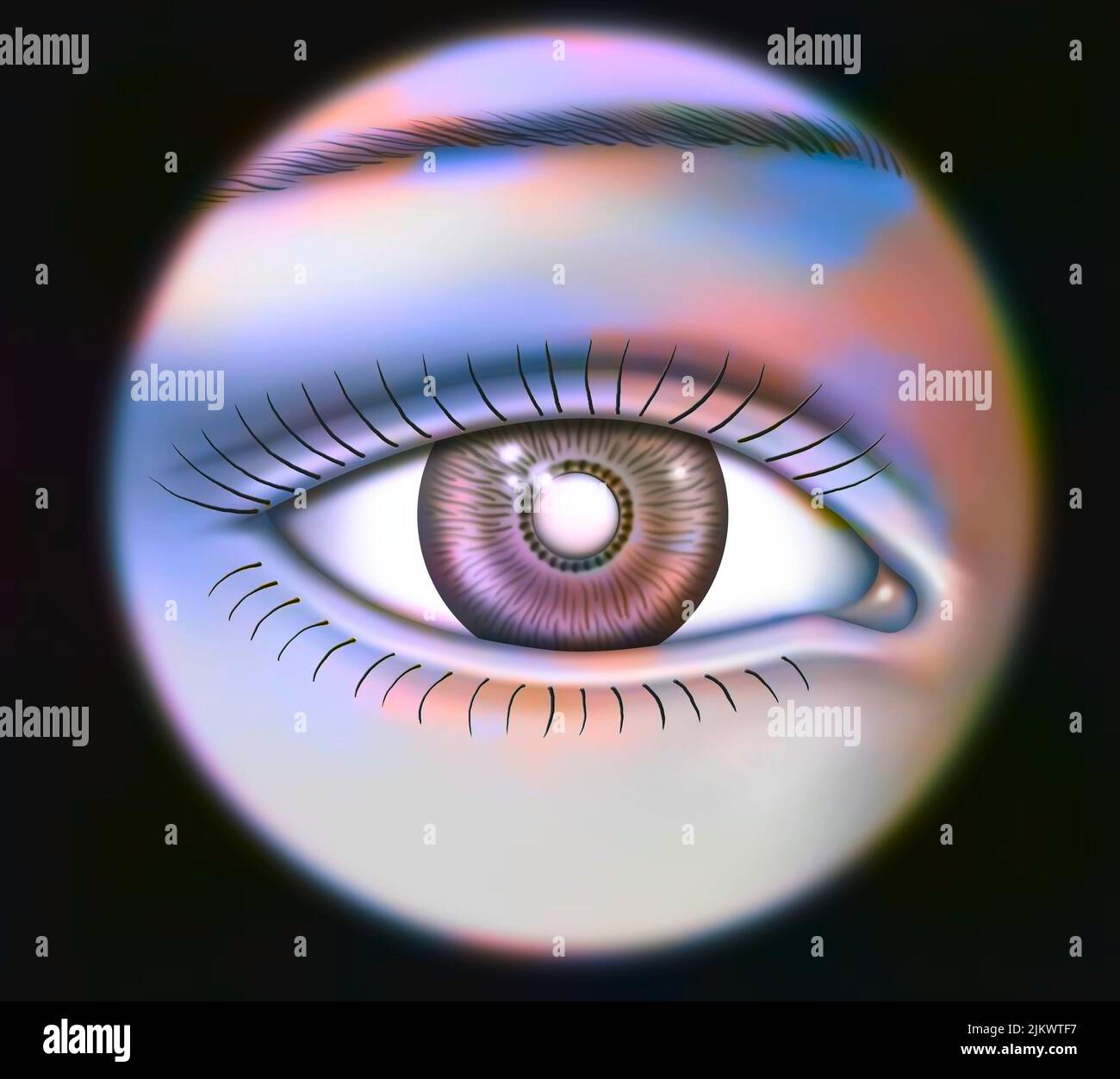 Eye lens completely opacified during a total cataract Stock Photo Alamy