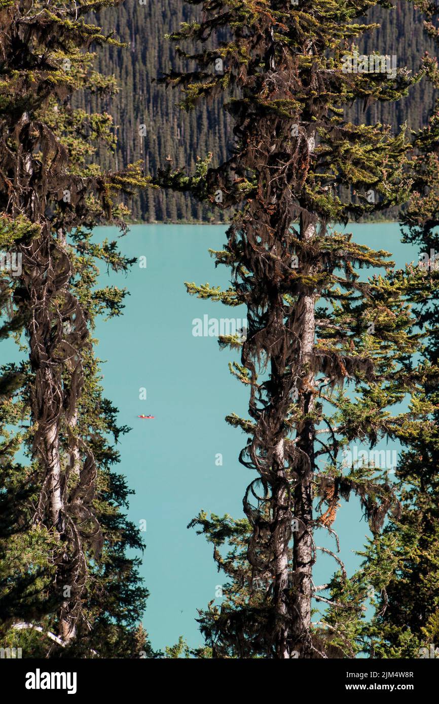 Lake Louise in Banff National Park Stock Photo - Alamy