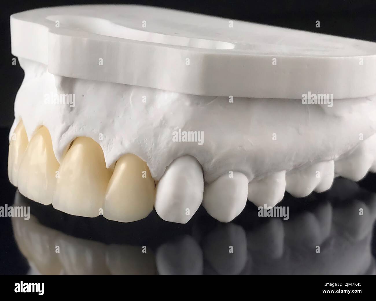 Dental technician working in a ceramic crowns. Technical shots of tooth