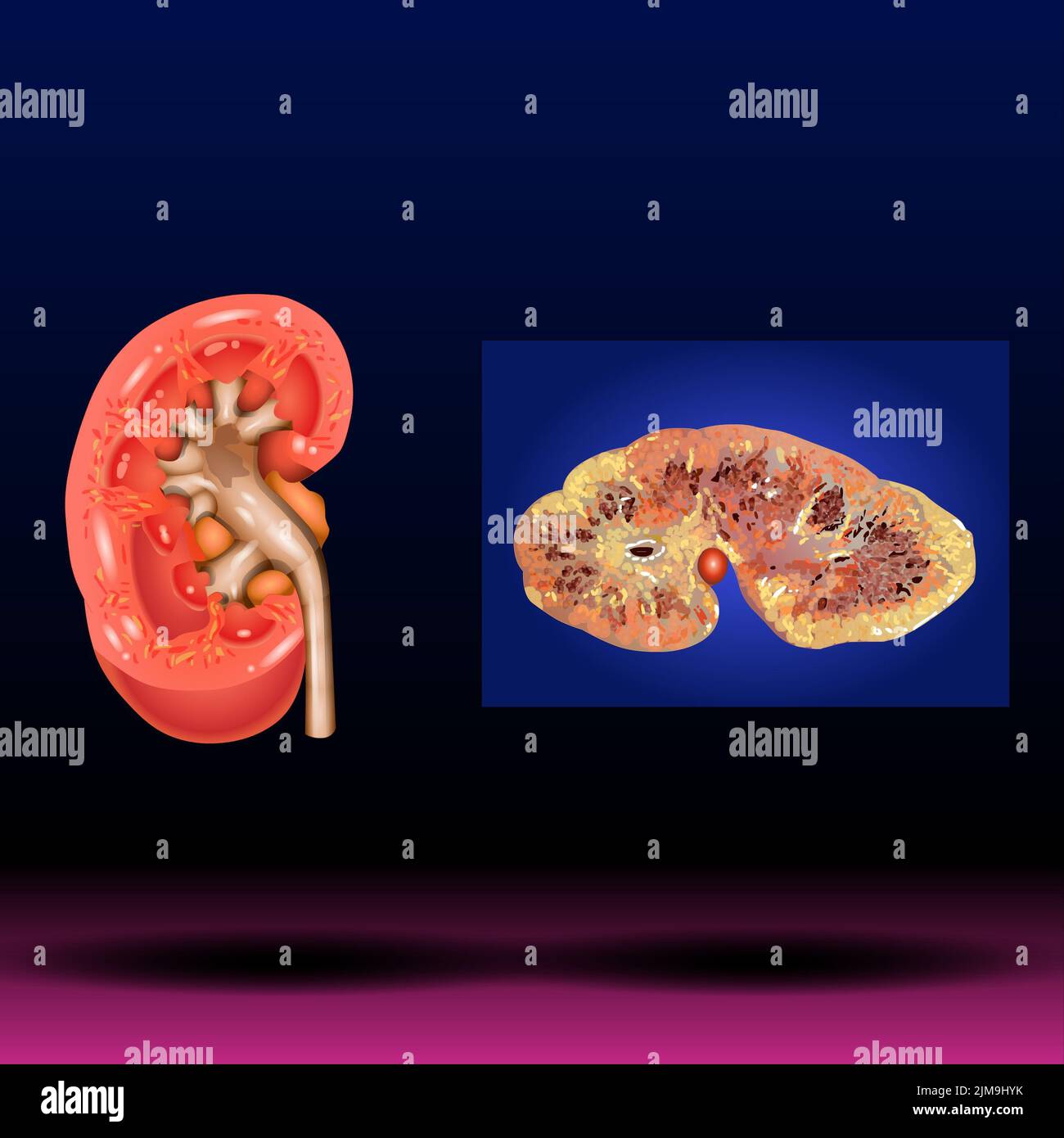 Nephrology main image 0