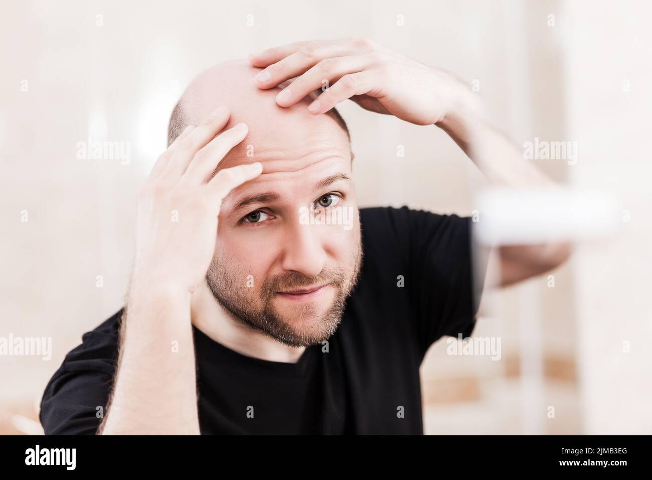 Bald man looking mirror at head baldness and hair loss Stock Photo