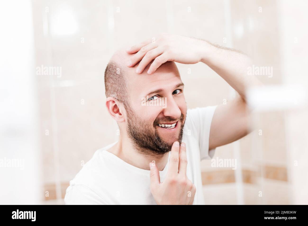 Bald man looking mirror at head baldness and hair loss Stock Photo