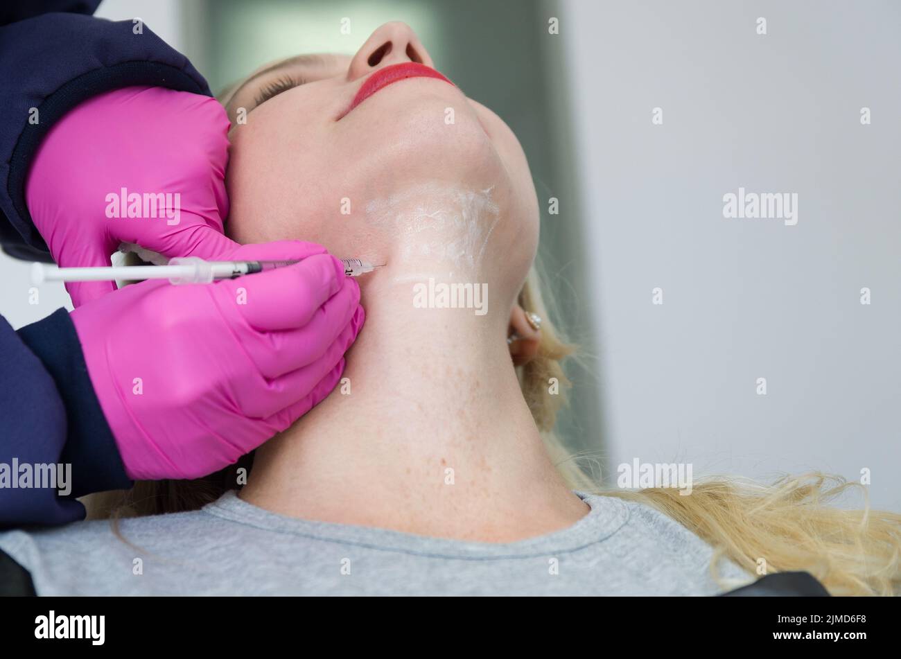 Great concept of aesthetic treatment of jowls, injection of deoxycholic acid. Stock Photo