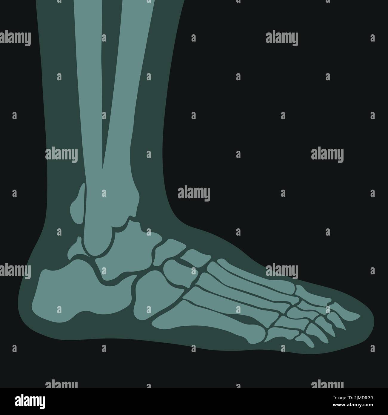 Xray of foot, joints and bones roentgen scans Stock Vector Image & Art