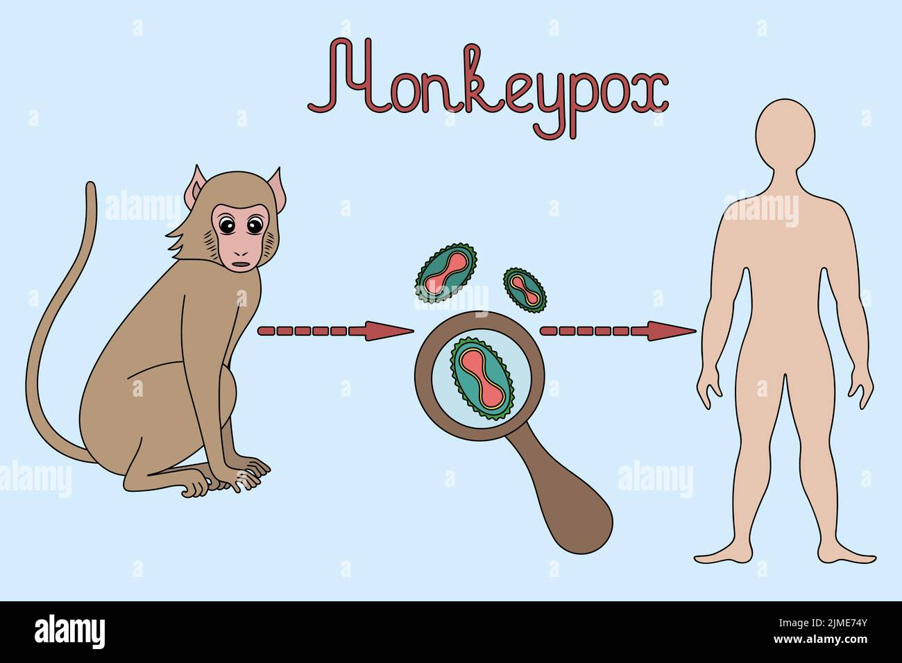 Monkeypox. Diagram of human infection with the smallpox virus. Monkey - virus - man. Color vector illustration. Zoonotic viral disease. Stock Vector