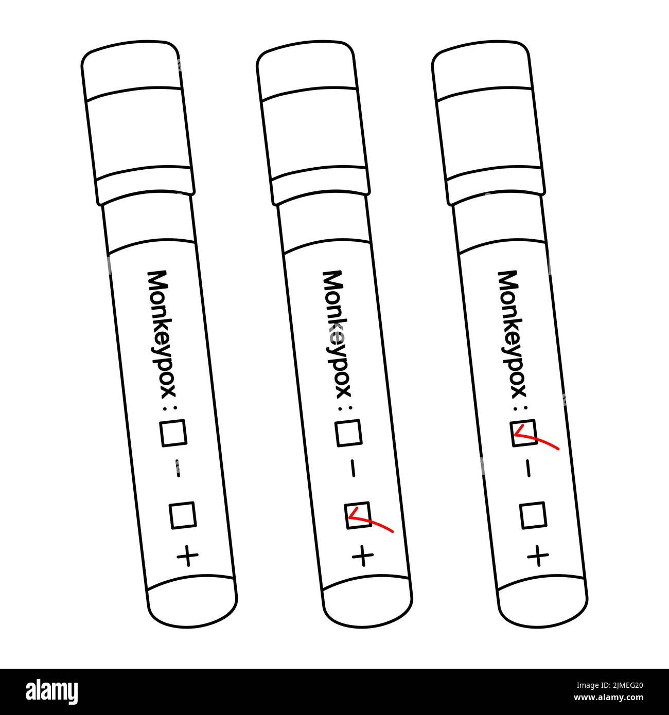 Diagnosis of blood samples for monkeypox virus. Test tubes with patient tests. Set of vector illustrations. Result: positive, negative, unfinished. Stock Vector