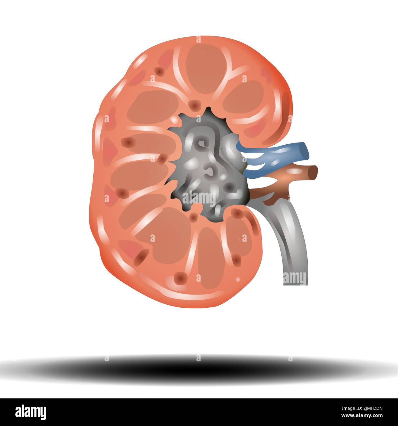 Kidney - internal organ, Kidney stones. Renal calculi, nephrolithiasis or urolithiasis. Healthcare concept, vector illustration on white background Stock Photo