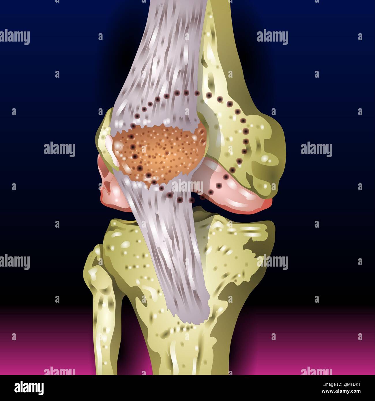 Bones Pain, Injury and Inflammation, Knee Joint Pain Silhouette Icon Ache of Knee, Leg Skeleton, Arthritis, Osteoporosis and Bones Joint, Illustration Stock Photo