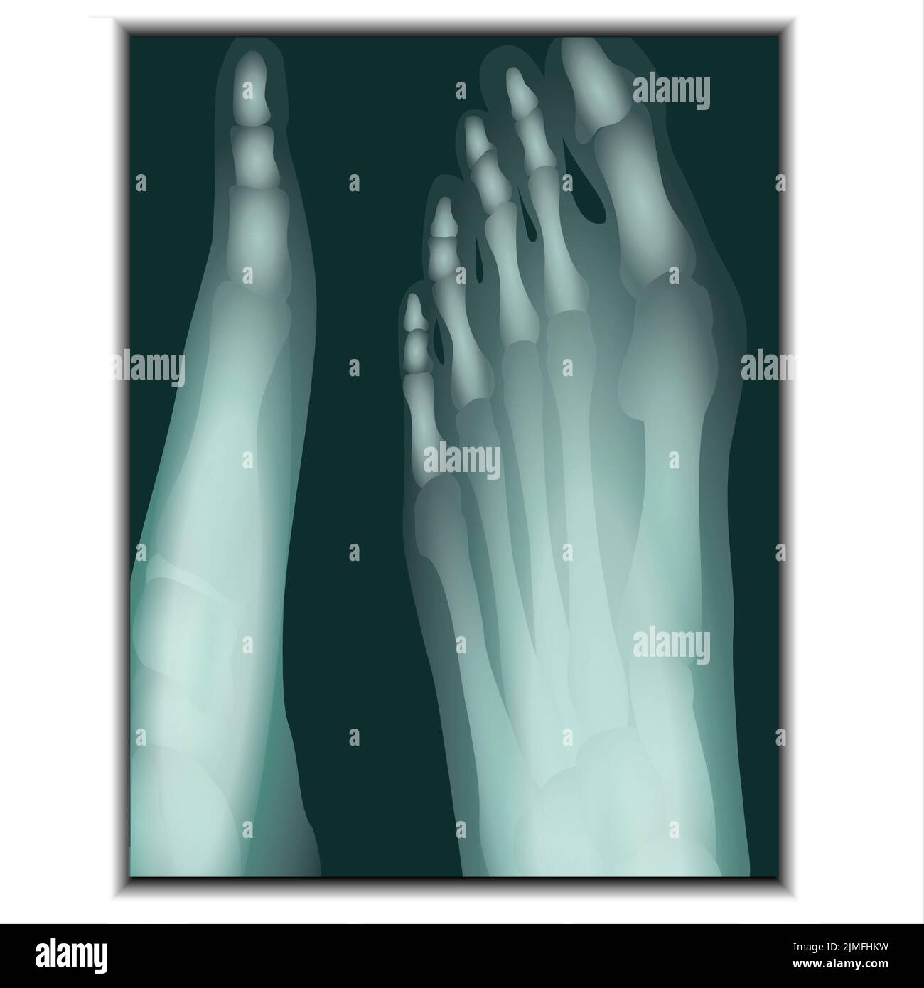 X-ray of Foot Stock Photo