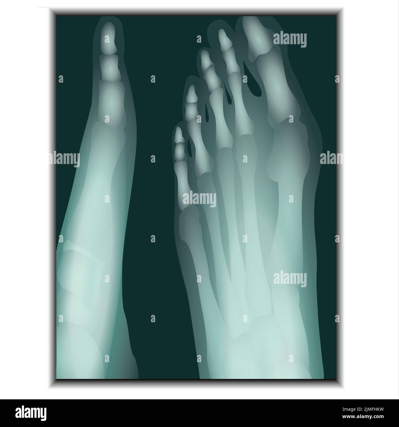 Xray of Foot Claw Stock Photo Alamy