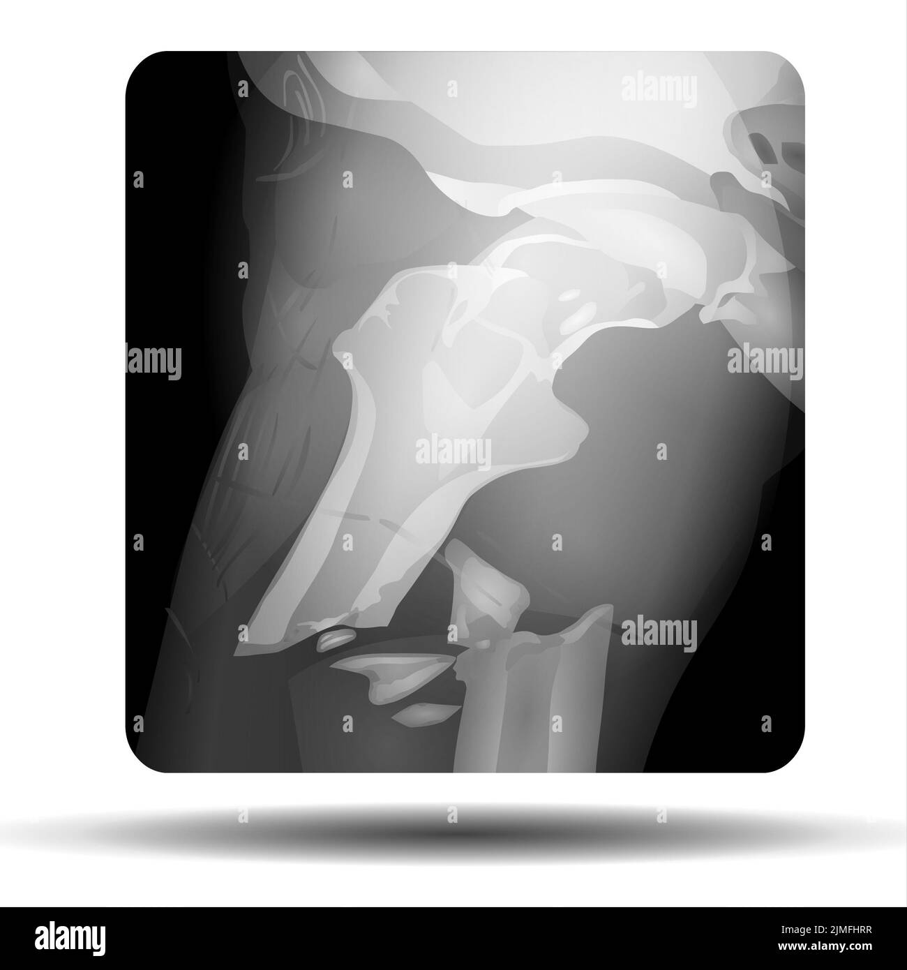 Thigh anatomy man Black and White Stock Photos & Images Alamy