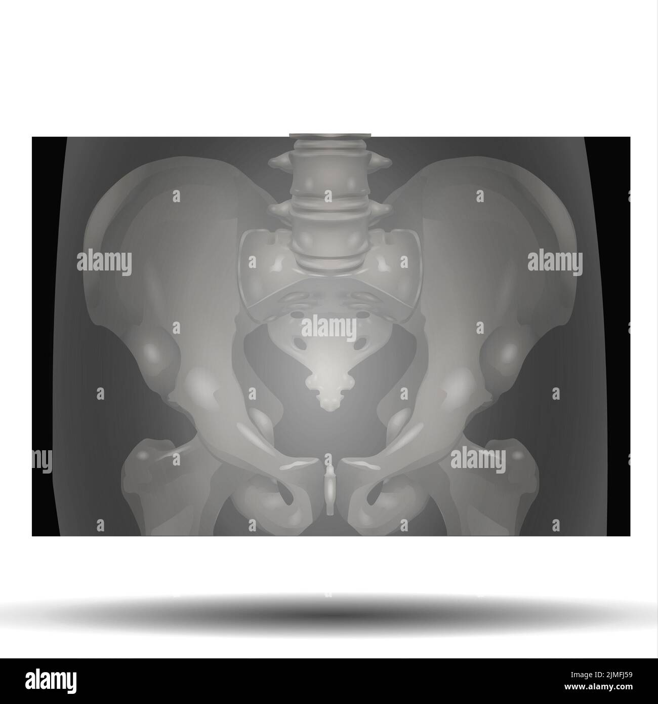 XRay of Pelvis Stock Photo Alamy