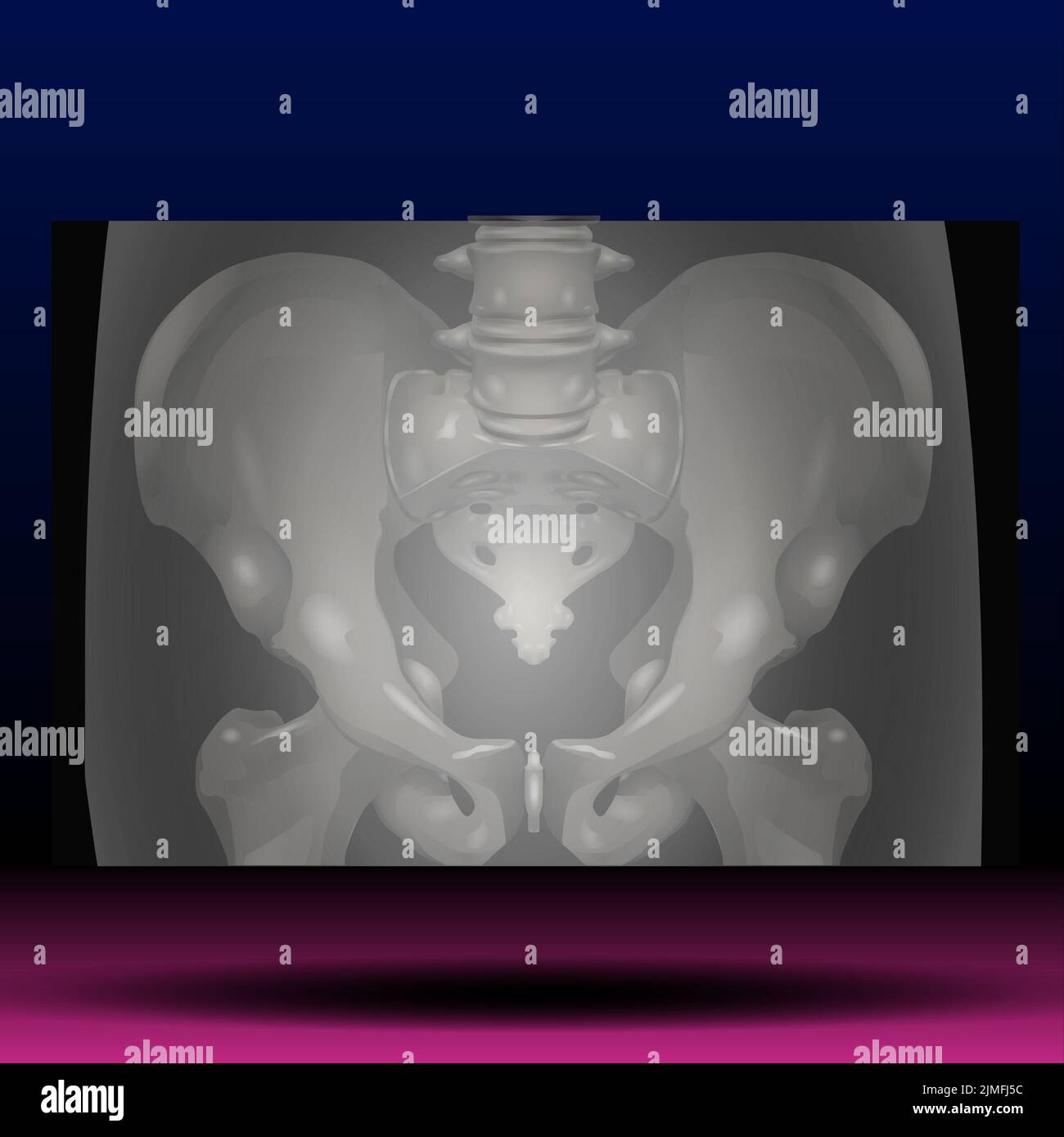 XRay of Pelvis Stock Photo Alamy