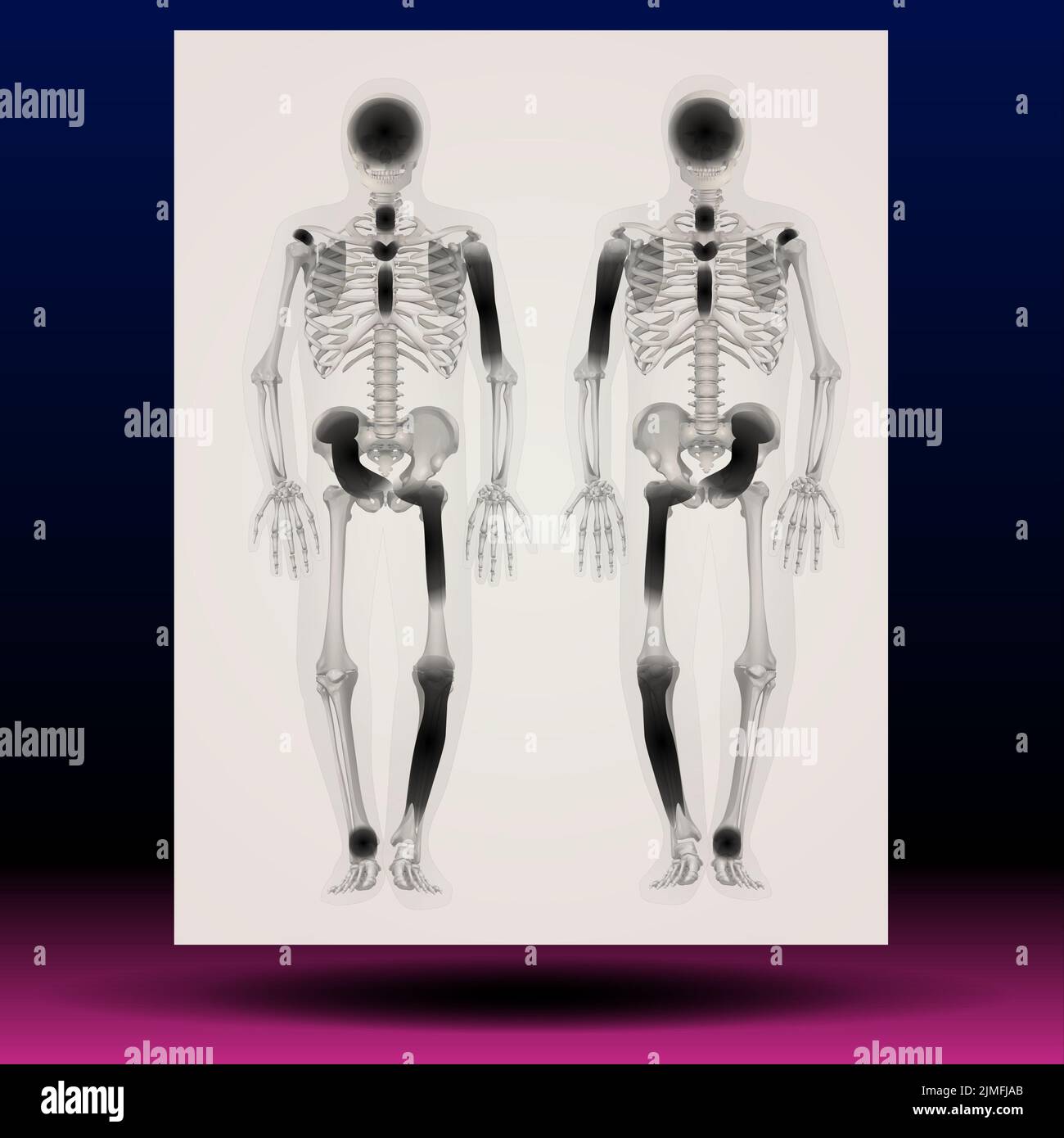 X-ray illustration of a human skeleton Stock Photo