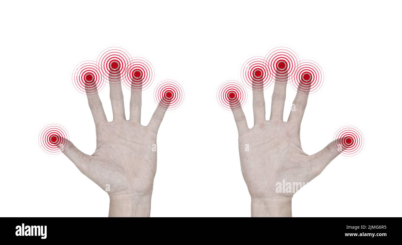 Pain, tingling and numbness in fingertips of Asian young man with