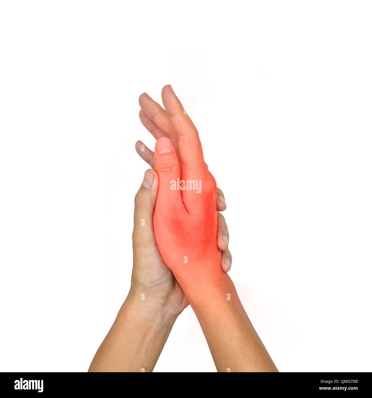 Painful hand of Asian young man. Concept of cellulitis and hand muscles pain. Stock Photo