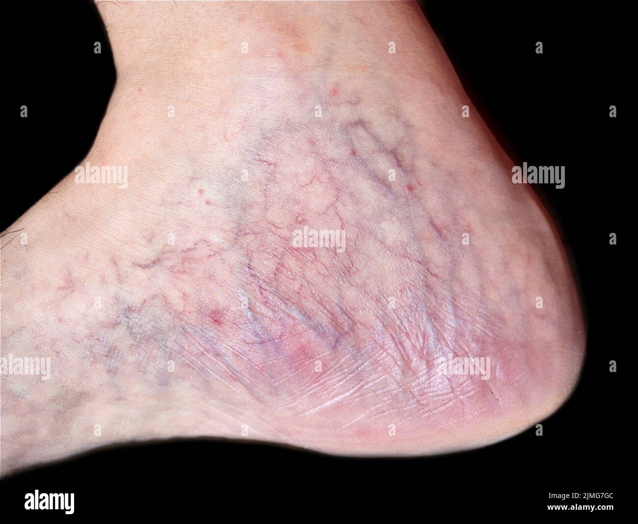 Skin wrinkles and prominent veins visible through the thin foot skin of Asian old man. Stock Photo