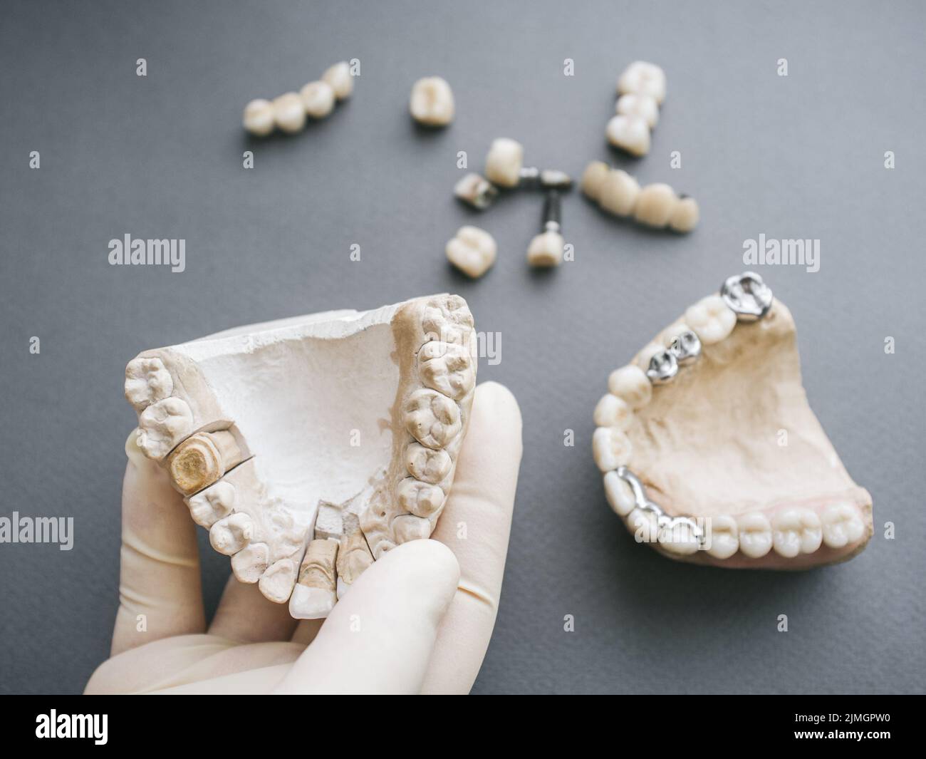 Orthodontic dentistry gypsym jaw denture forceps Stock Photo Alamy
