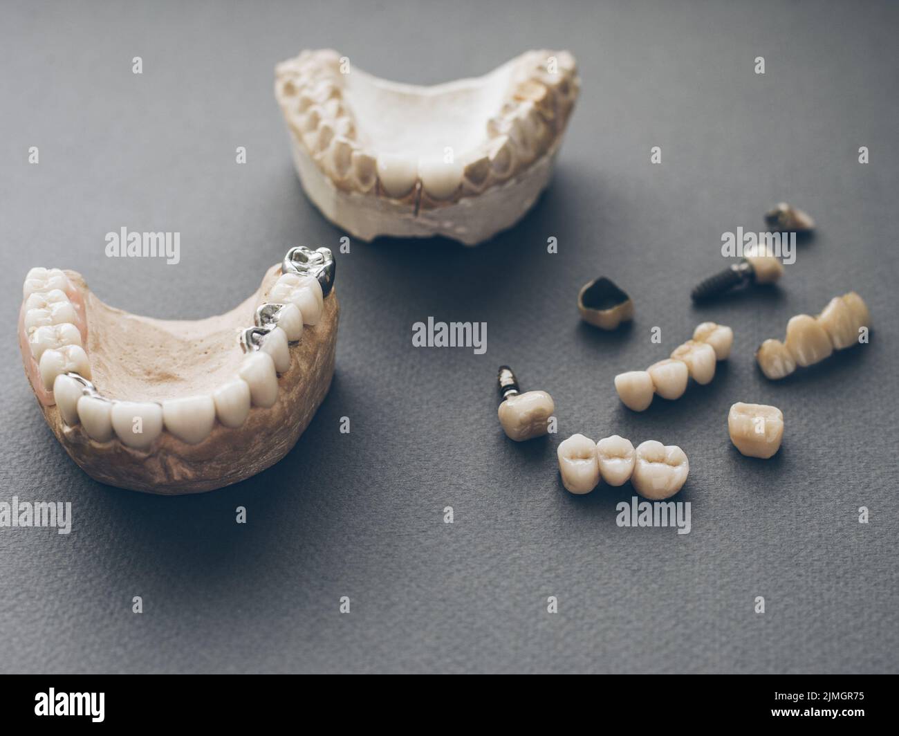 orthodontics prosthetics jaws dentures crowns Stock Photo