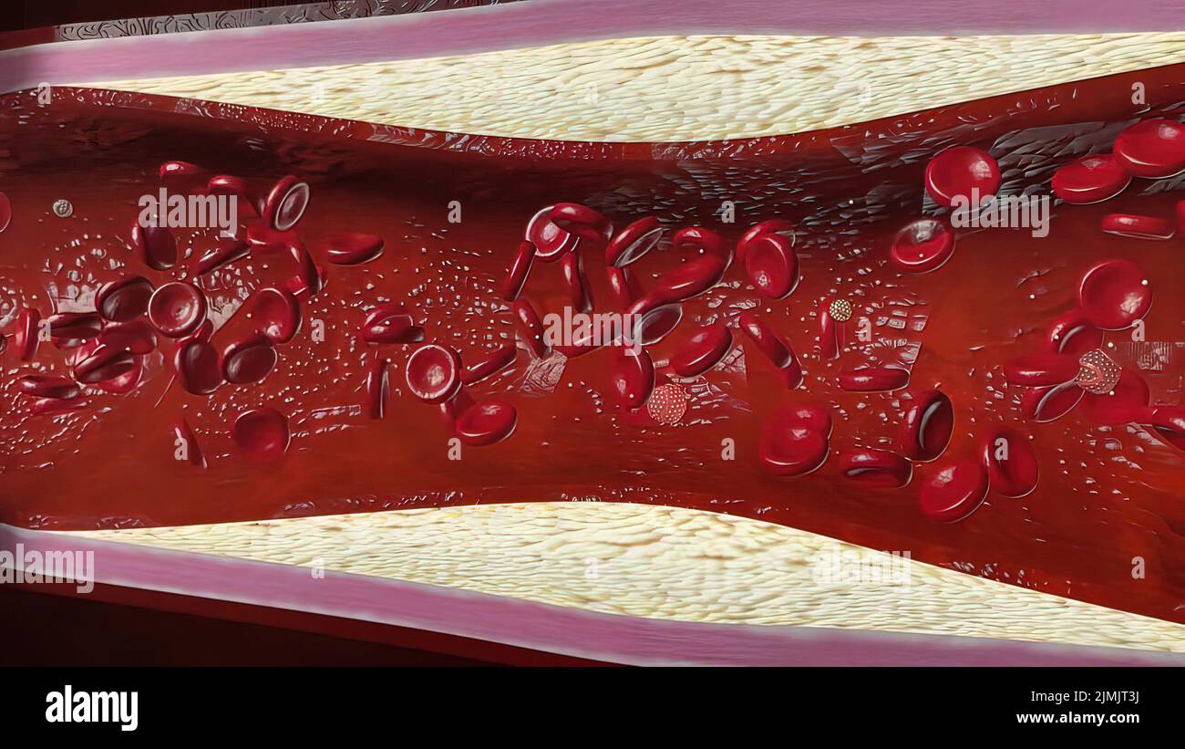 Blood vessel 3d tree hires stock photography and images Alamy