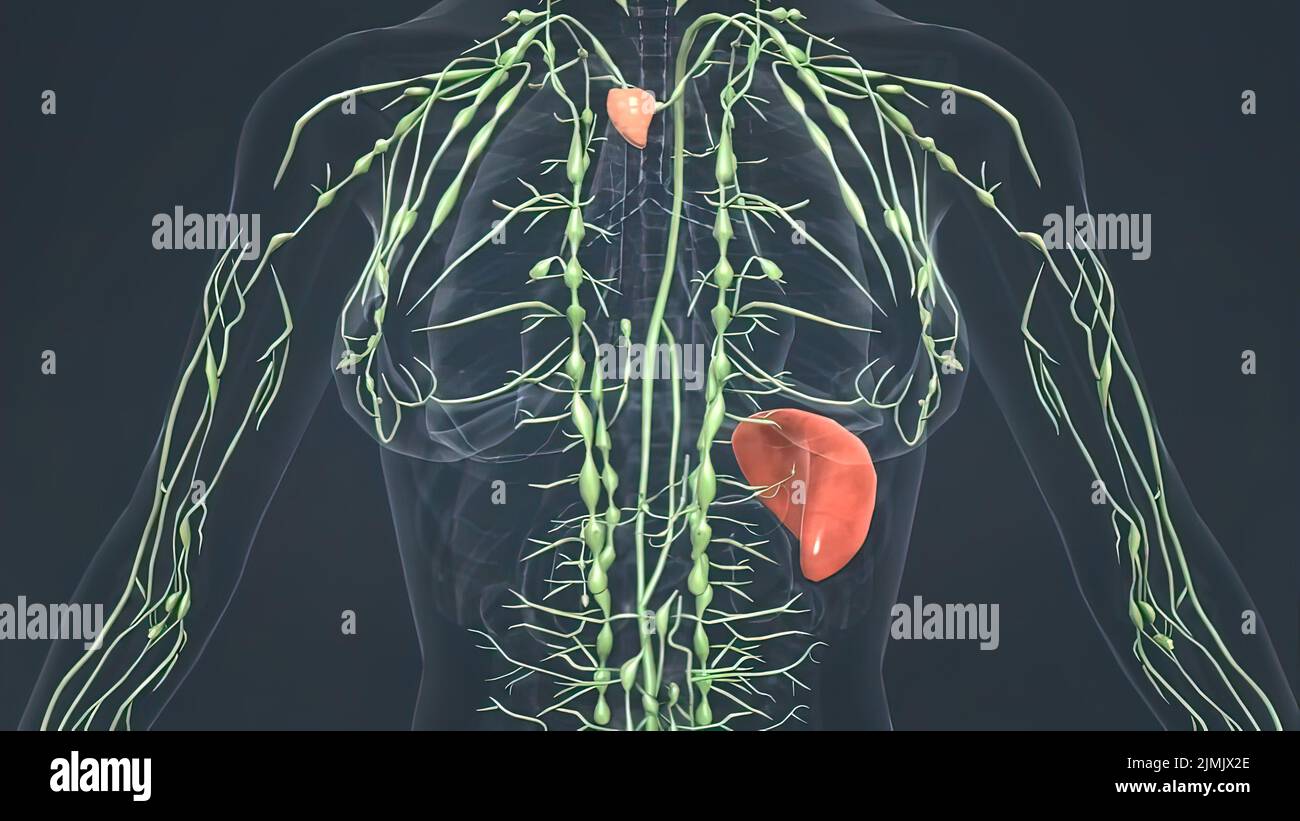 Inflammation of lymph node hires stock photography and images Alamy