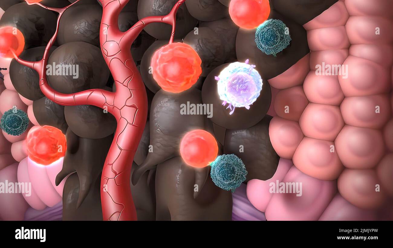 Skin cancer removal hi-res stock photography and images - Alamy