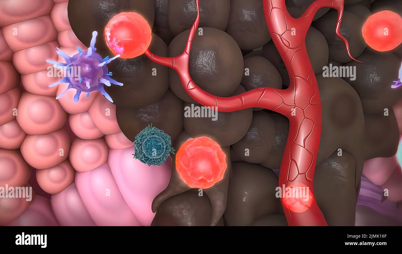 Skin cancer removal hi-res stock photography and images - Alamy