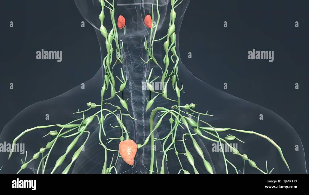 Inflammation of lymph node hires stock photography and images Alamy