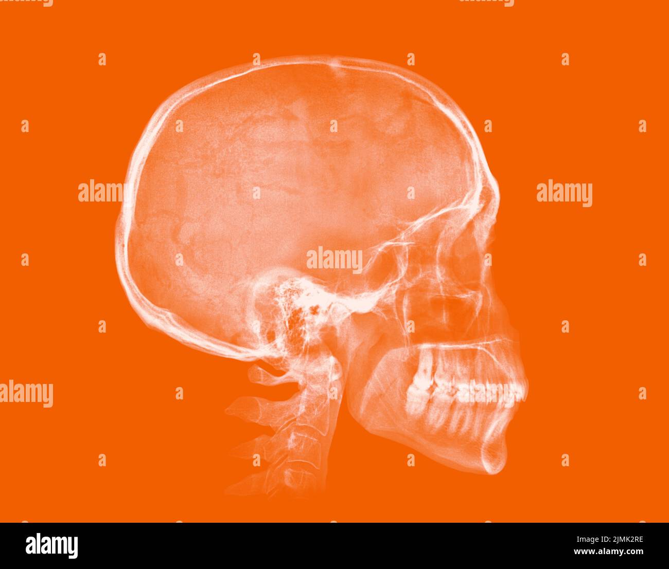 Human skull. X-ray image on orange background Stock Photo - Alamy