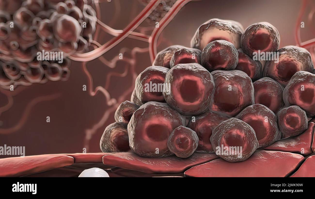 Cancer cells blood hi-res stock photography and images - Alamy