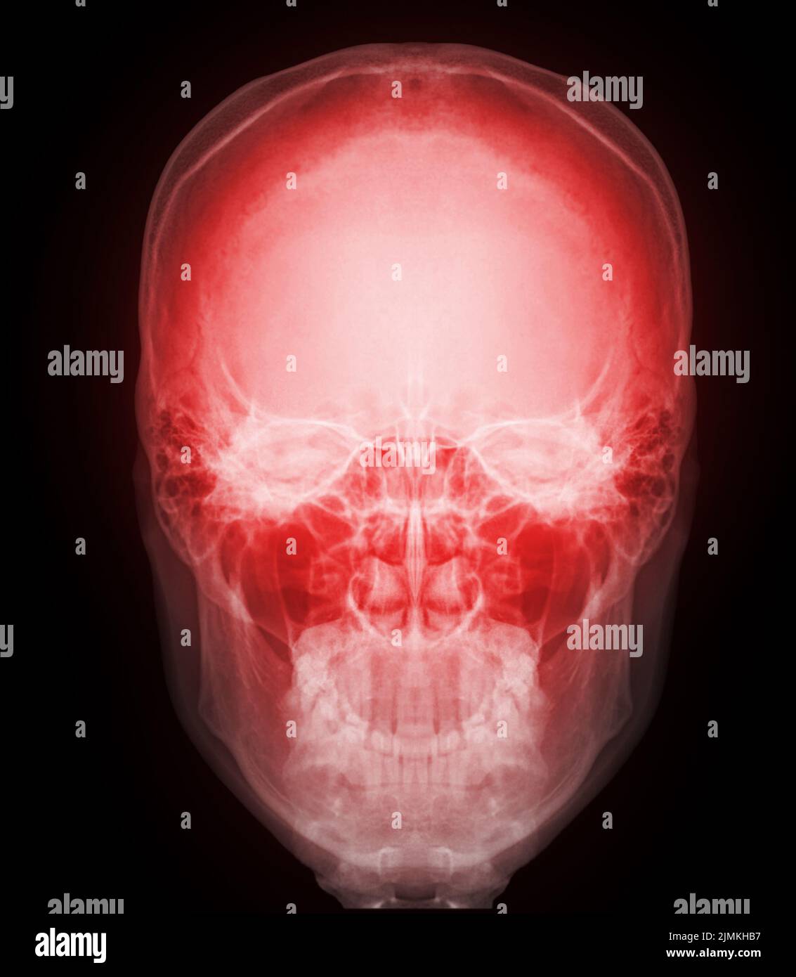 Skull x-ray image of Human front view isolated on Black Background