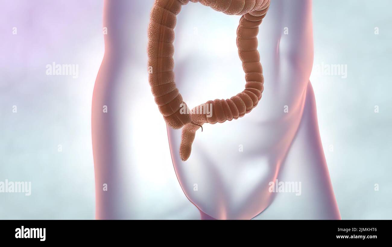 Intestin colon hi-res stock photography and images - Alamy