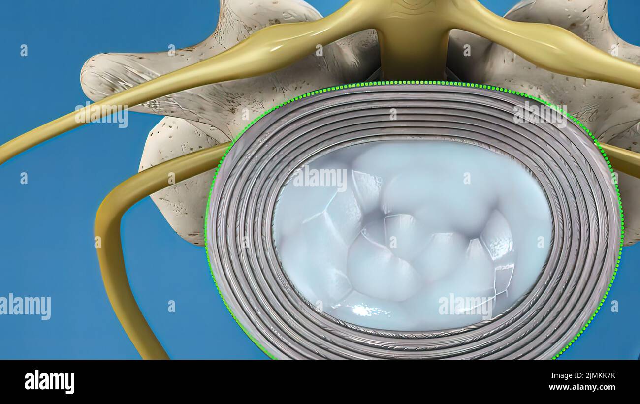 Slippage hires stock photography and images Alamy