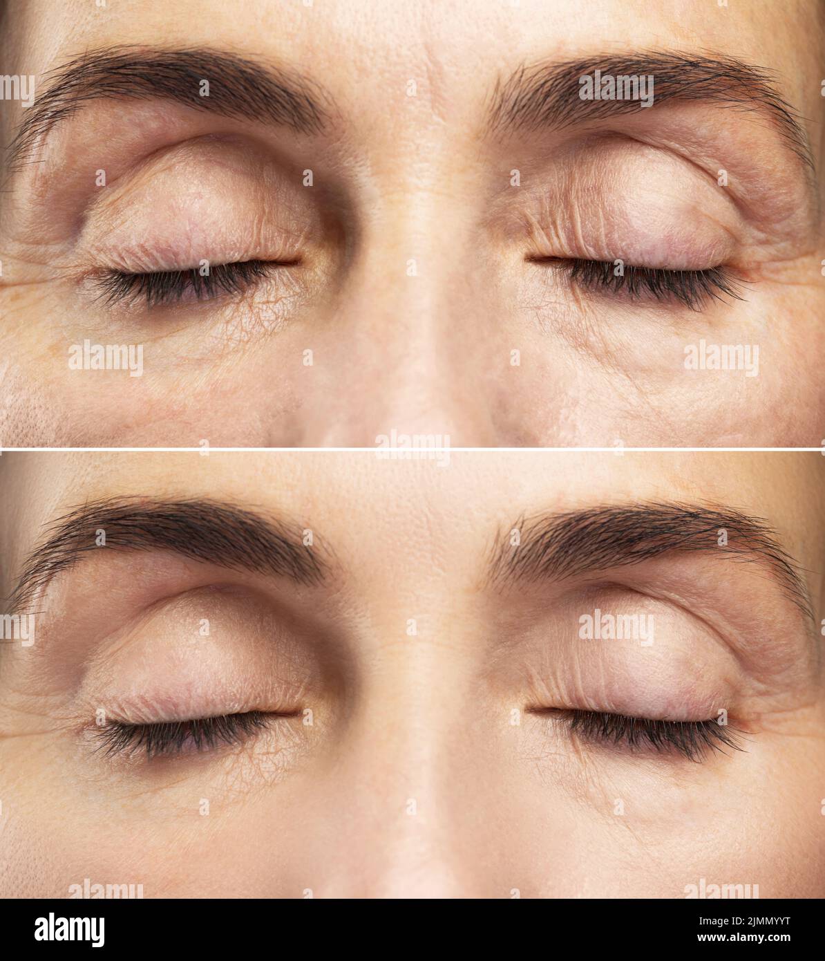 Anti aging treatment. Female eyes after rejuvenation Stock Photo Alamy