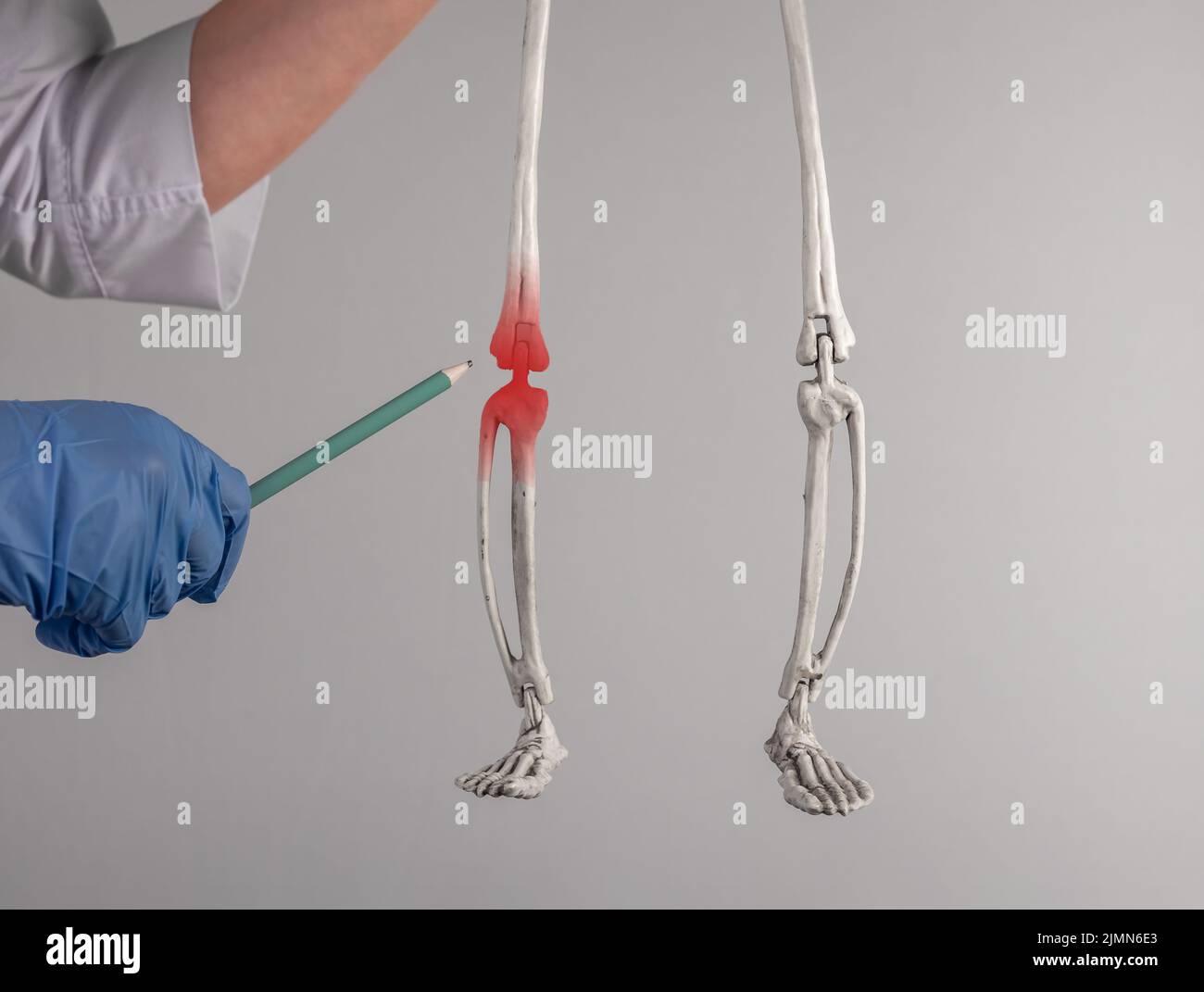 Artificial ligaments hires stock photography and images Alamy