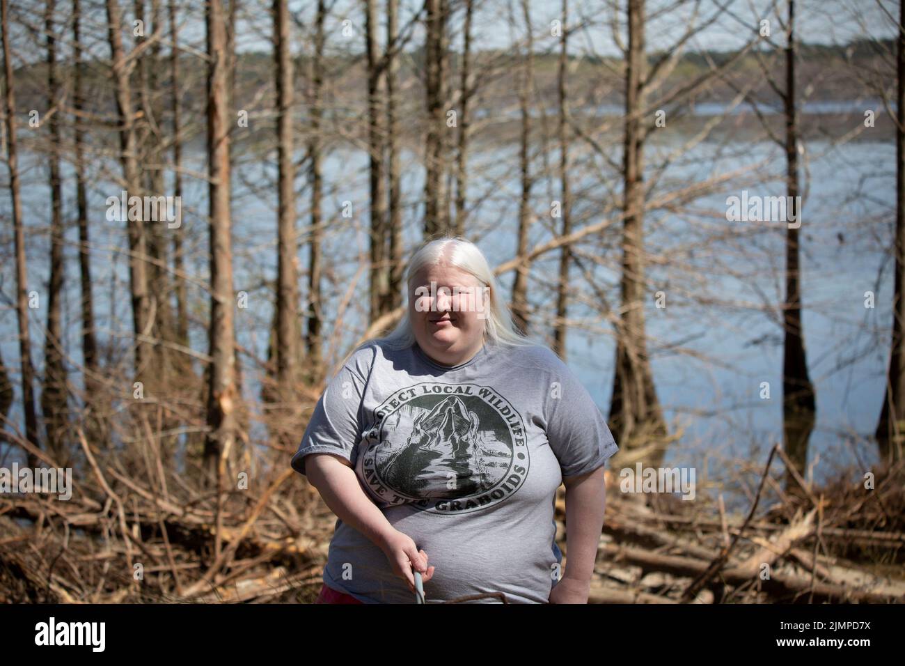 Albino woman holding a cane and smiling in front of a tree line near a shore Stock Photo