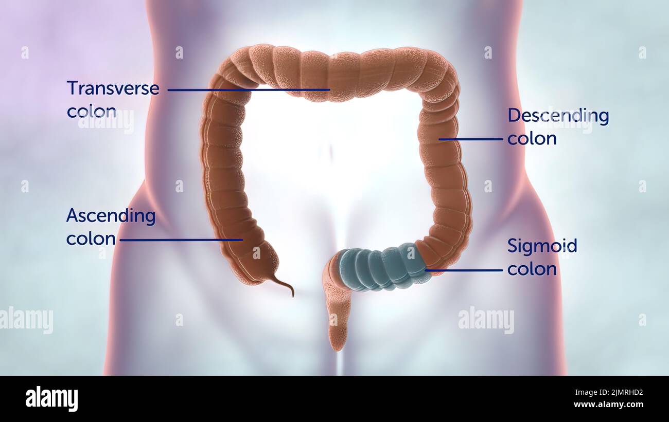 Human large intestine pain illustration hi res stock photography and