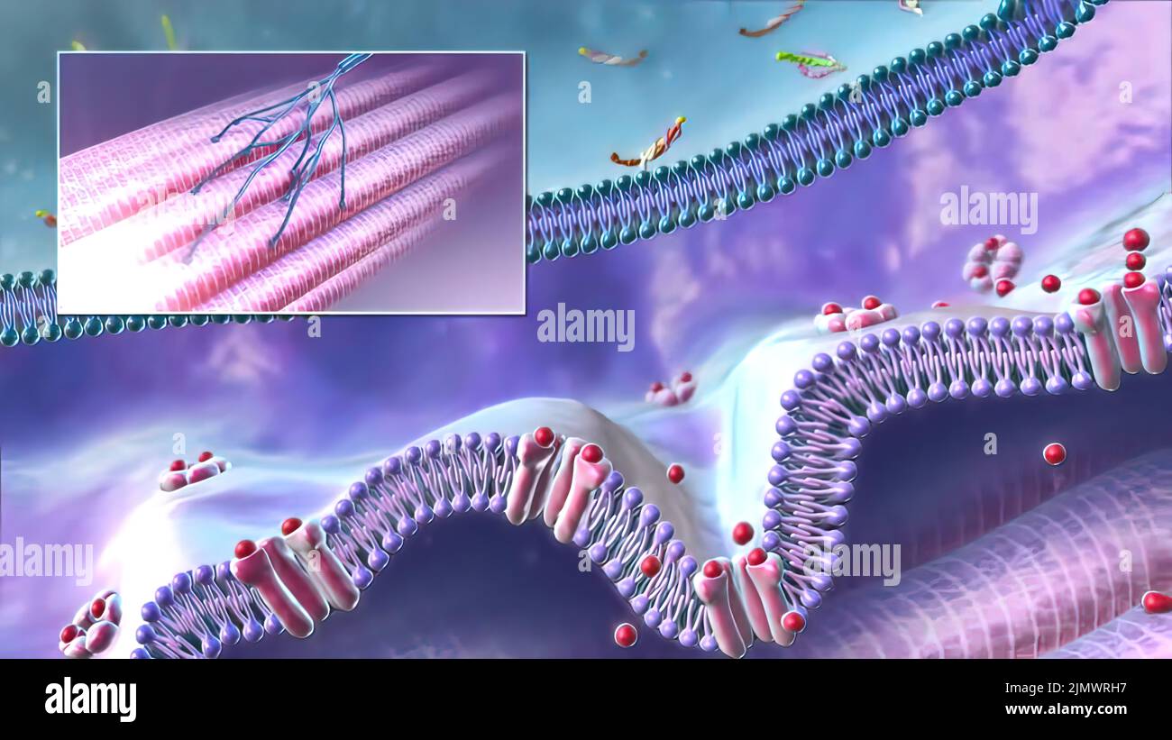 Neurons With Amyloid Plaques Stock Photo Alamy