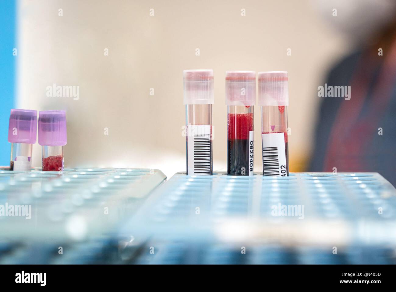 Blood sample in tubes, collected from patients. Close up view Stock