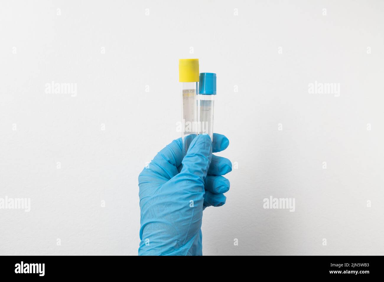 vacuum tube for collection and blood samples in blue gloves for laboratory. On white background Stock Photo