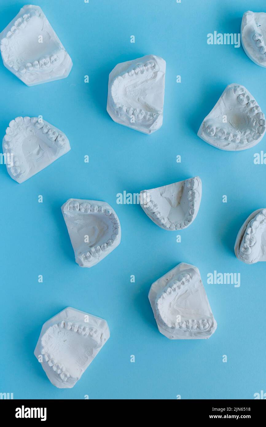 Lots of dental plaster cast of human theeth Stock Photo Alamy