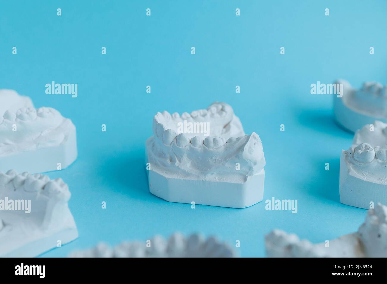 Gypsum model of teeth. Stomatologic plaster cast molds of human jaws on blue background. Dentistry and orthodontics concept Stock Photo
